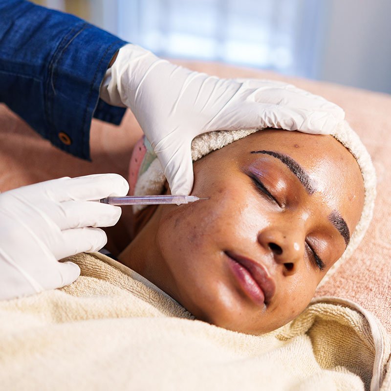 Hair Mesotherapy